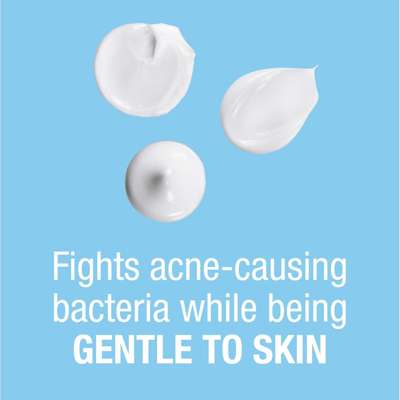 Acne Spot Treatment Cream | Vanishing Acne Cream | Lootiva